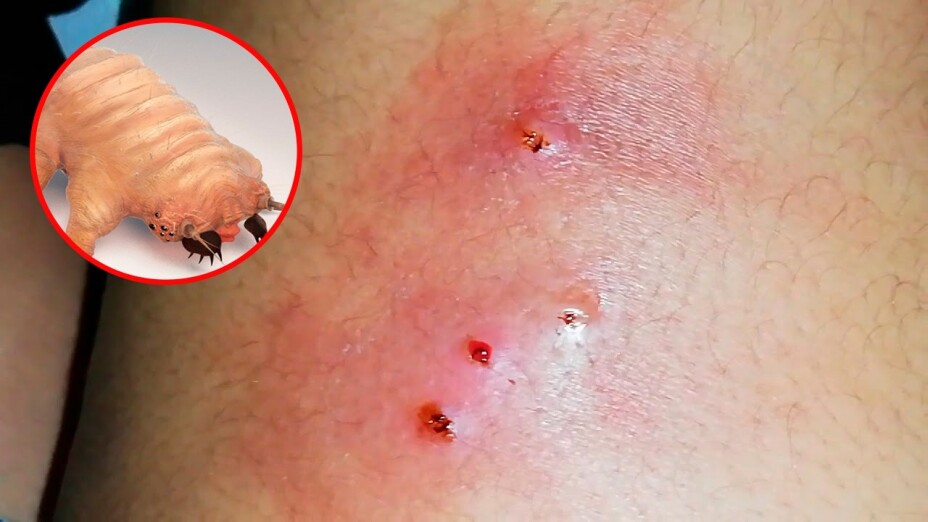 Sesal reporta 169 casos de gusano barrenador en humanos en todo el país.